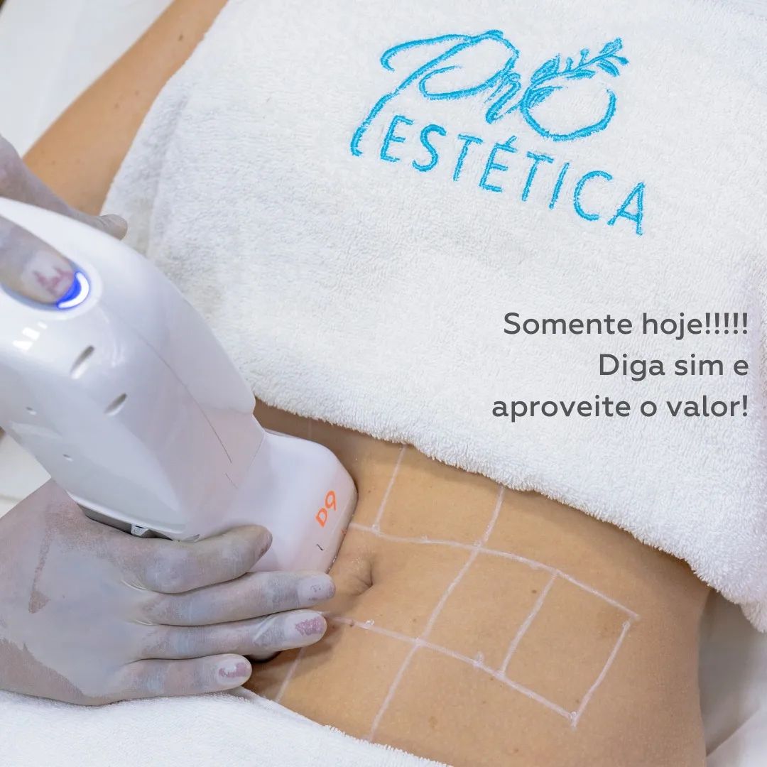 Radiofrequência